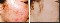 Peeling facial