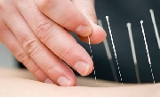 Curso de acupuntura duracion 6 meses