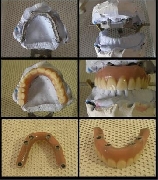 Tecnico superior en mecanica dental