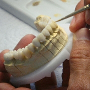 Laboratorio dental juan felipe serna