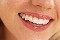 Limpieza dental- blanqueamiento- endodoncia